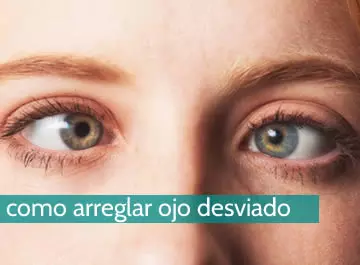 Cómo arreglar un ojo desviado